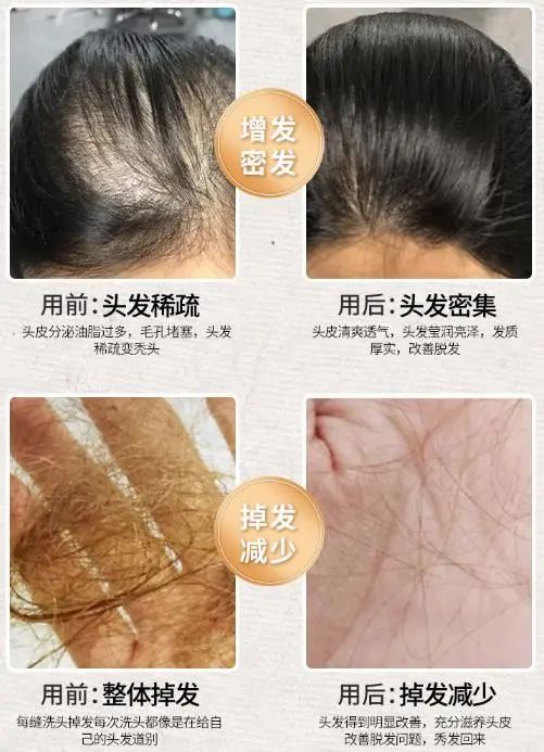 孩子有白头发是缺少什么微量元素