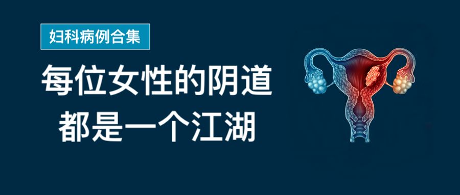 孕妇补铁