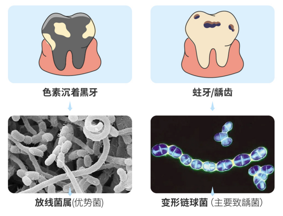 补铁牙齿变黑了怎么办