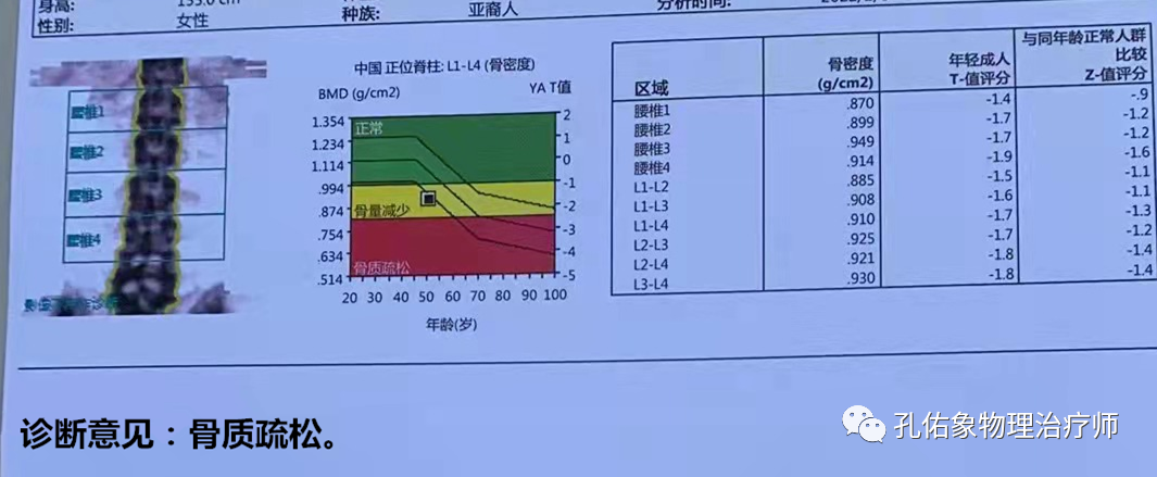 50岁补钙吃什么钙片好