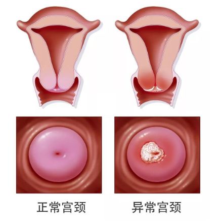麦芽硒与硒维康一样吗