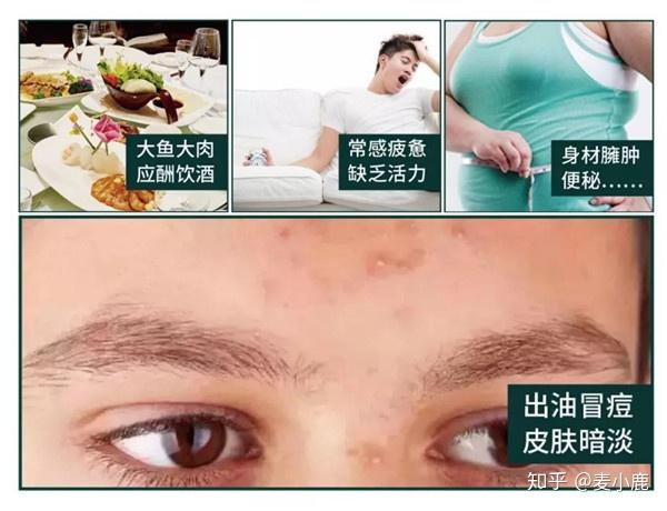硒维康副作用胸前长痘