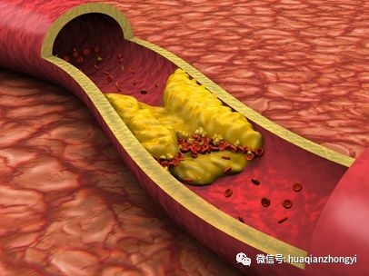 硒维康糖尿病可以吃吗
