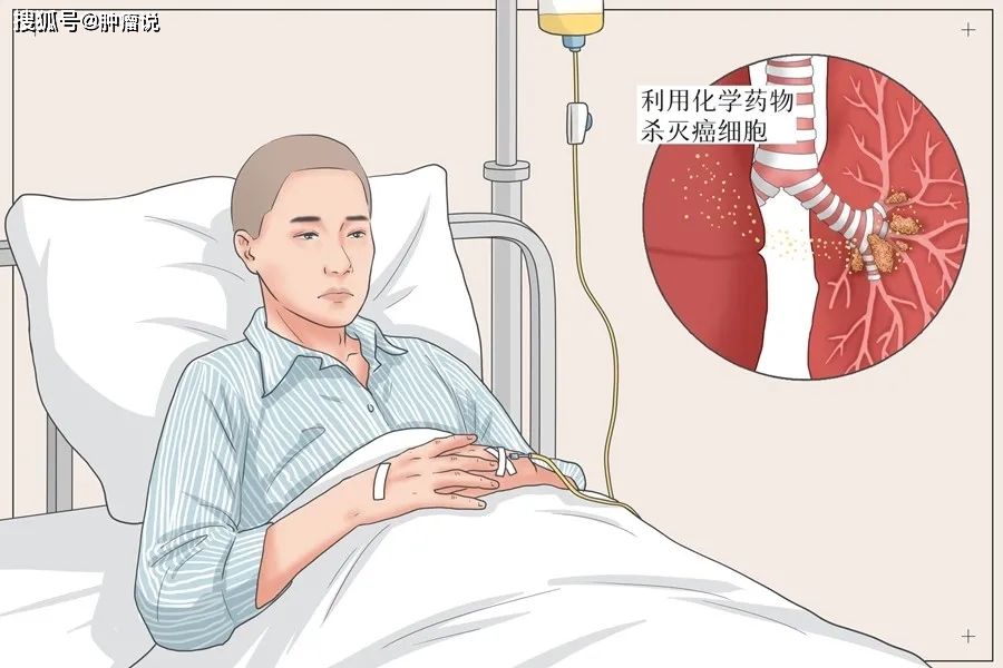 化疗期间能吃锌硒宝吗