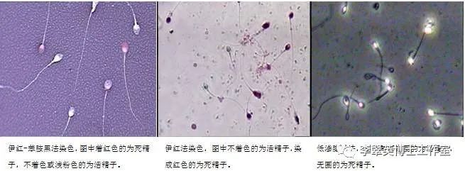 备孕时男性吃锌硒宝片
