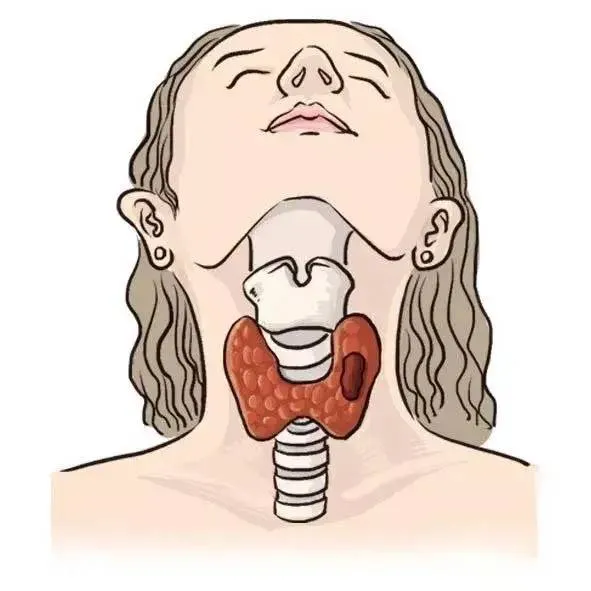 补硒对甲状腺结节有好处