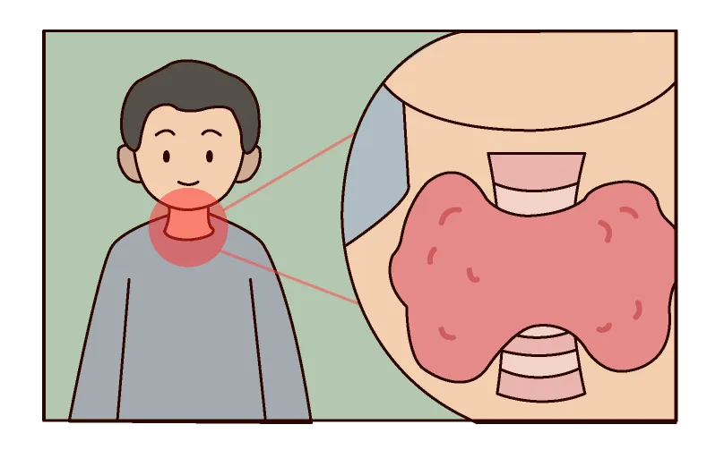 补硒对甲状腺结节有好处