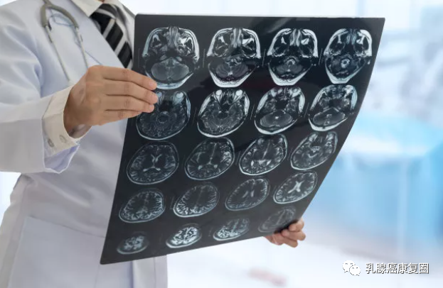 管状腺瘤切除可以补硒吗