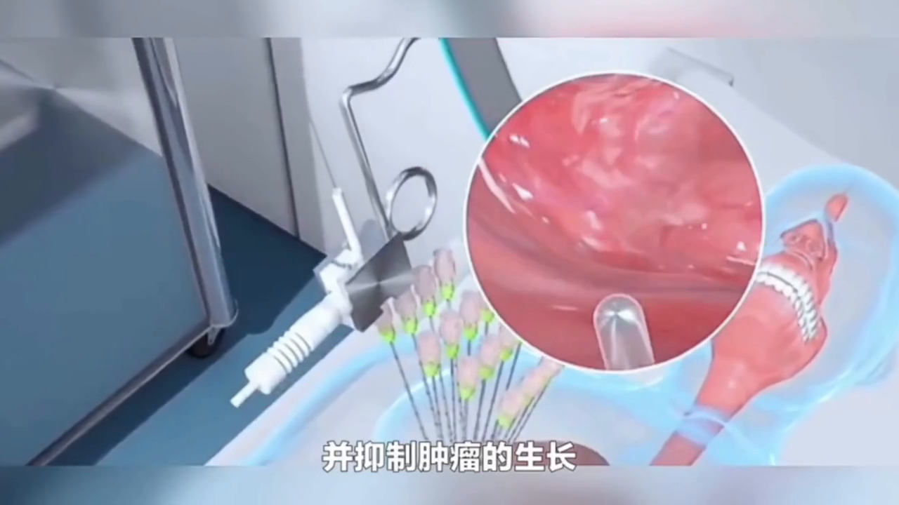 免疫力不够可以补硒吗吗