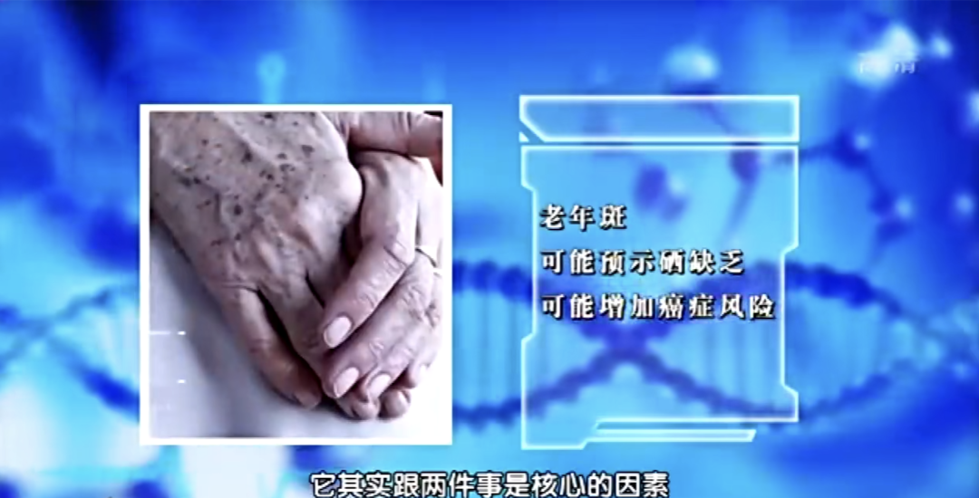 人体缺硒怎么办如何补硒