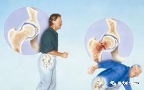 单纯甲减要补硒吗怎么补