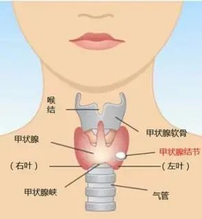 甲亢补硒推荐药物吗女性