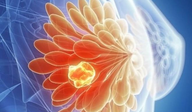 补硒导致乳腺增生加重吗