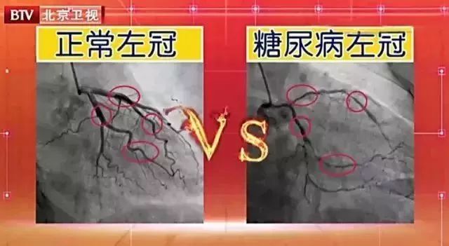 中老年如何补硒减肥最好