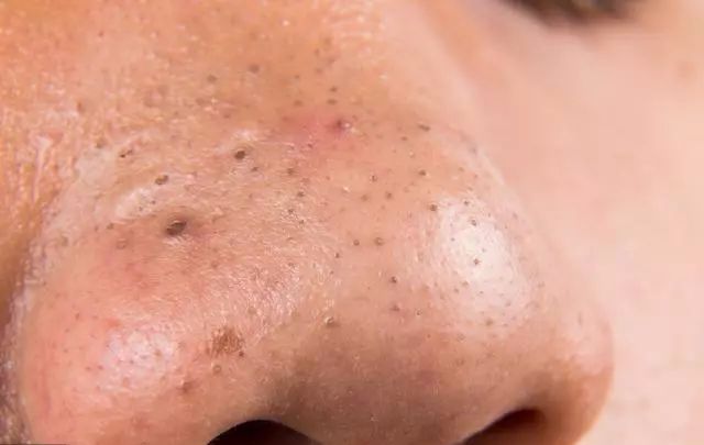 平时吃饭补硒吗好吗女性
