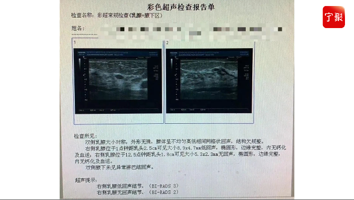 补硒能让乳腺结节消失吗