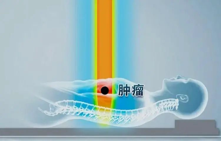 癌症患者为什么需要补硒