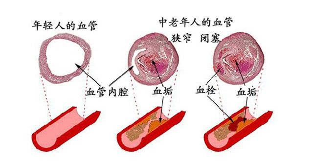 补硒怎么血糖比以前还高