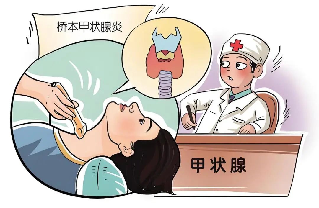 桥本氏甲状腺炎补硒剂量