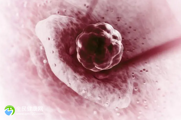 卵巢癌能不能喝蜂蜜？卵巢癌可以喝蜂蜜吗？