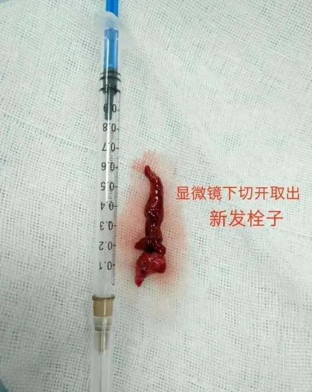 补硒有什么好处和副作用