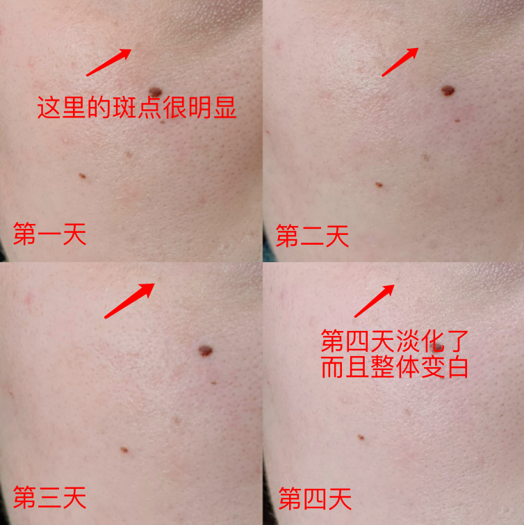 60岁女人补钙吃哪牌子
