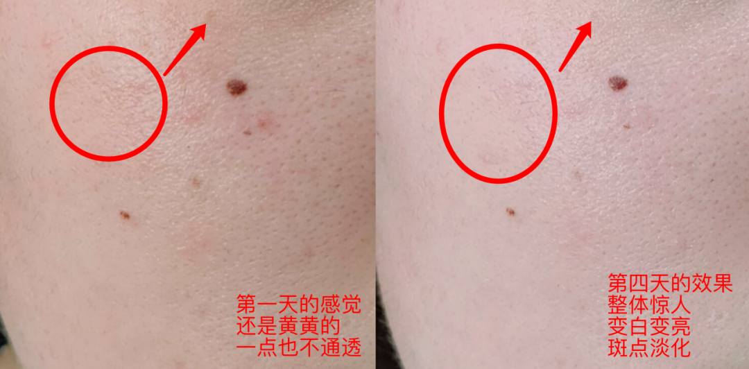 60岁女人补钙吃哪牌子
