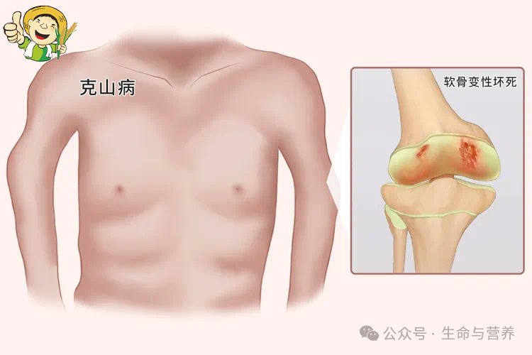 癌症有没有必要补硒元素