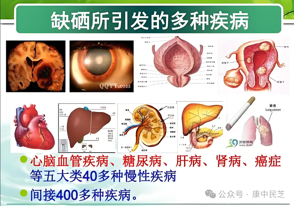 糖尿病了可以长期补硒吗