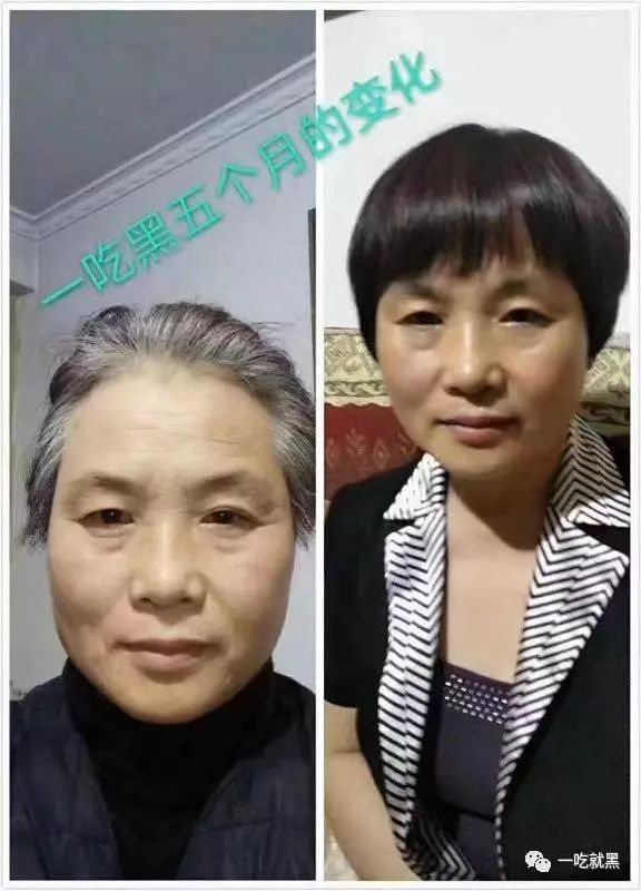 男人补硒吃什么保健品好