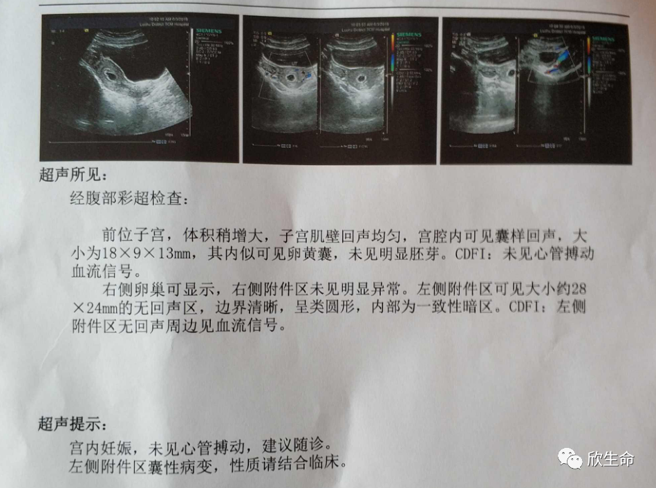 怀孕期间补多少硒最好呢