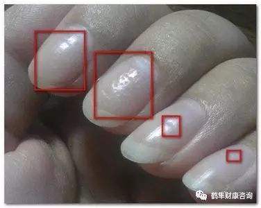 补硒会导致雄性激素过盛