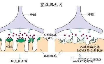 补硒能使风湿病人加重吗