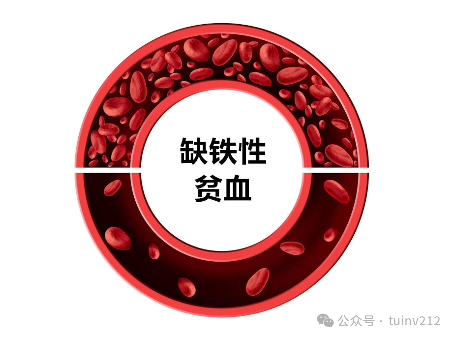 癌症补硒一天多少毫克量