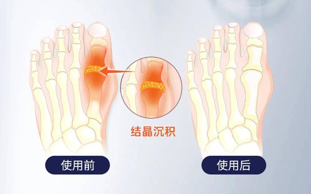 蛋白粉能和硒一块儿补吗