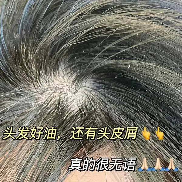 阿道夫有二硫化硒产品吗