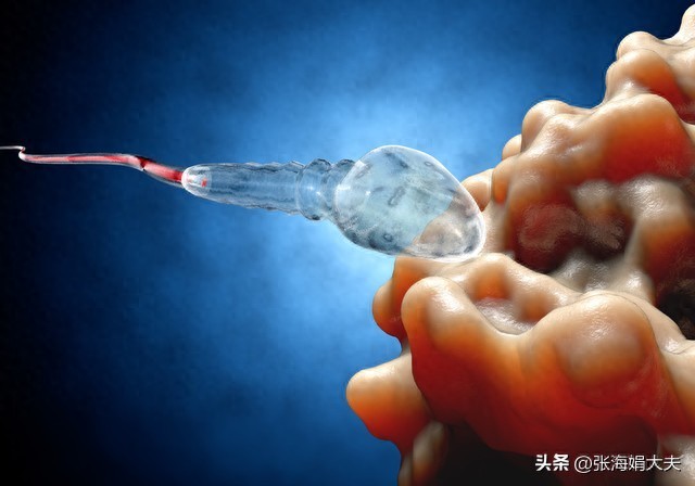 锌硒宝治疗精子质量差吗