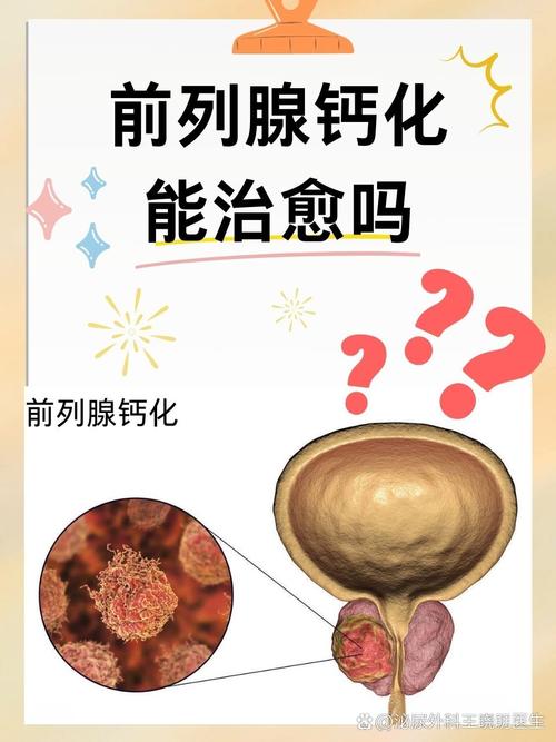 锌硒宝对前列腺炎的研究