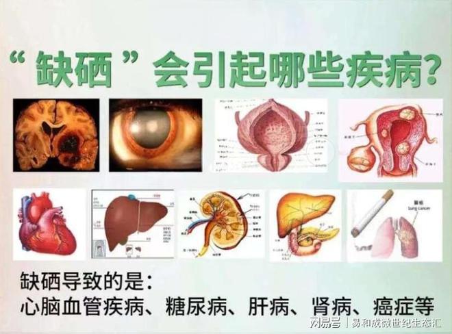 补硒过量怎么解毒