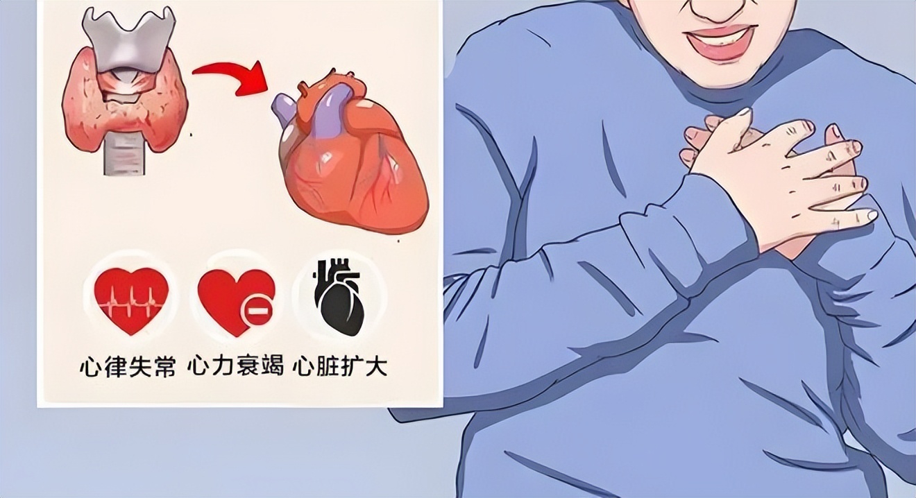 补硒可以治疗桥本甲状腺炎吗