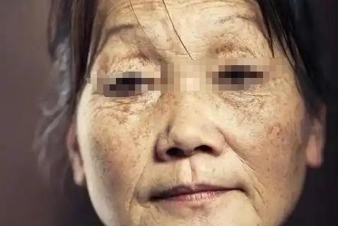 人体怎么补硒