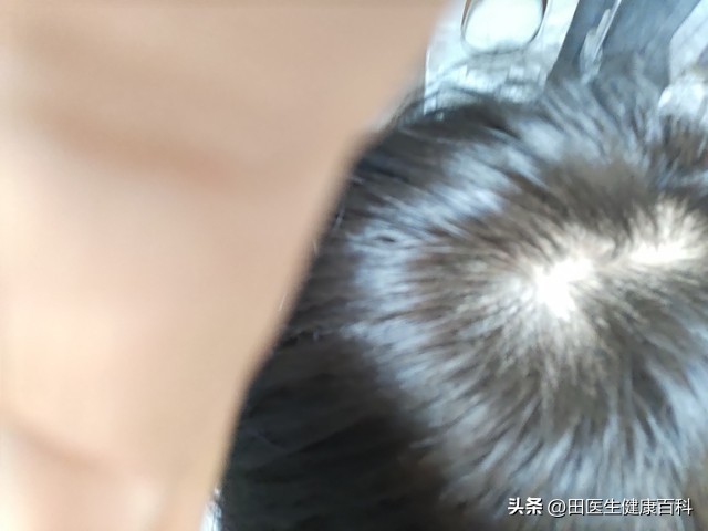 哪些人要补硒