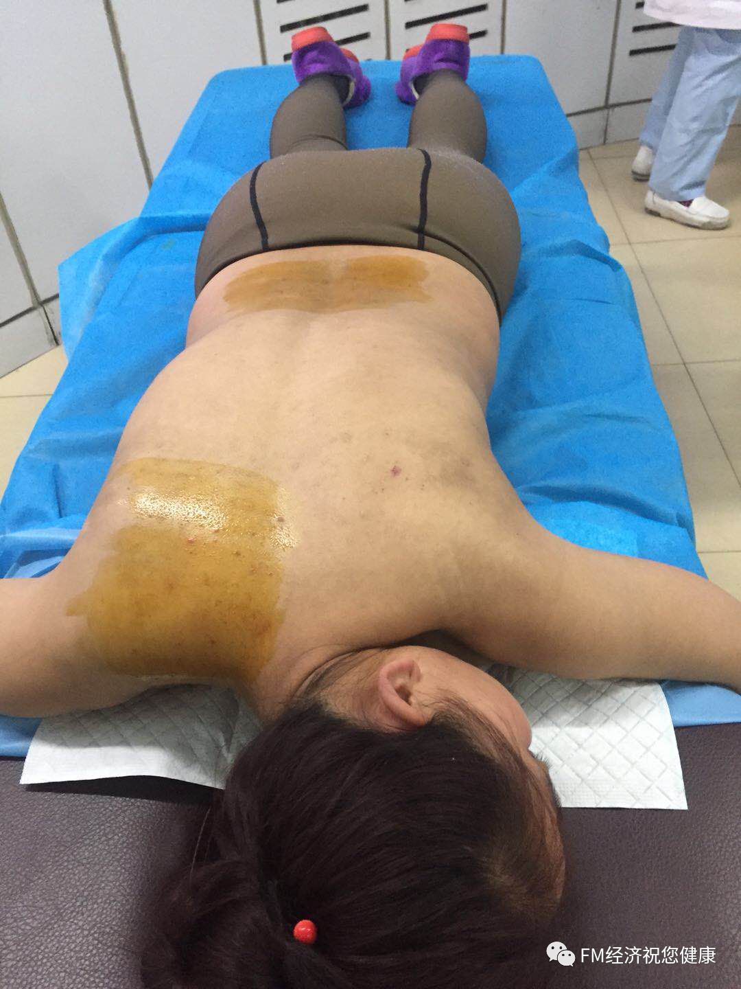 补硒治疗布病