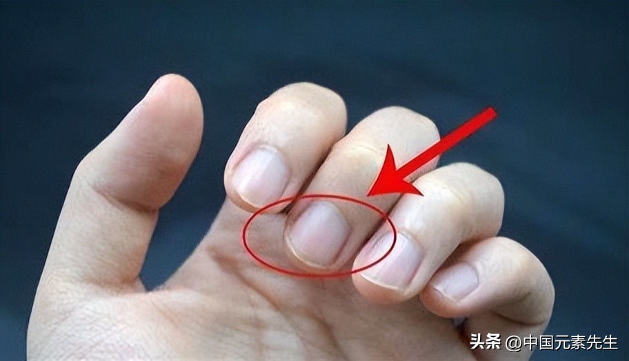 锌跟硒补什么