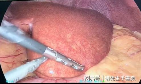 补硒会过敏吗