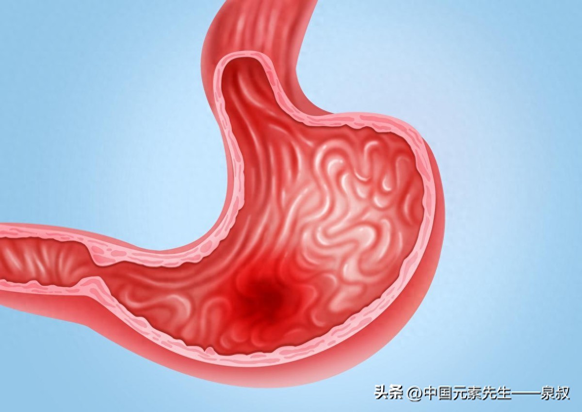 补硒改善胃病