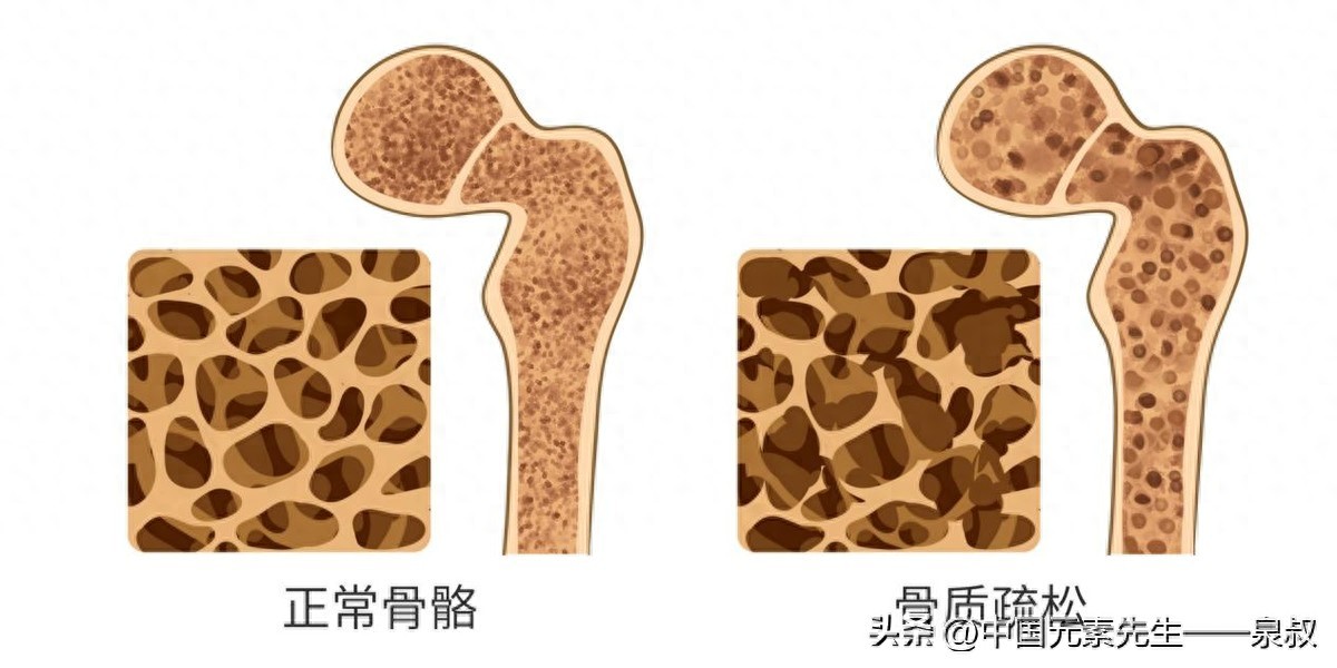 土壤补硒运动