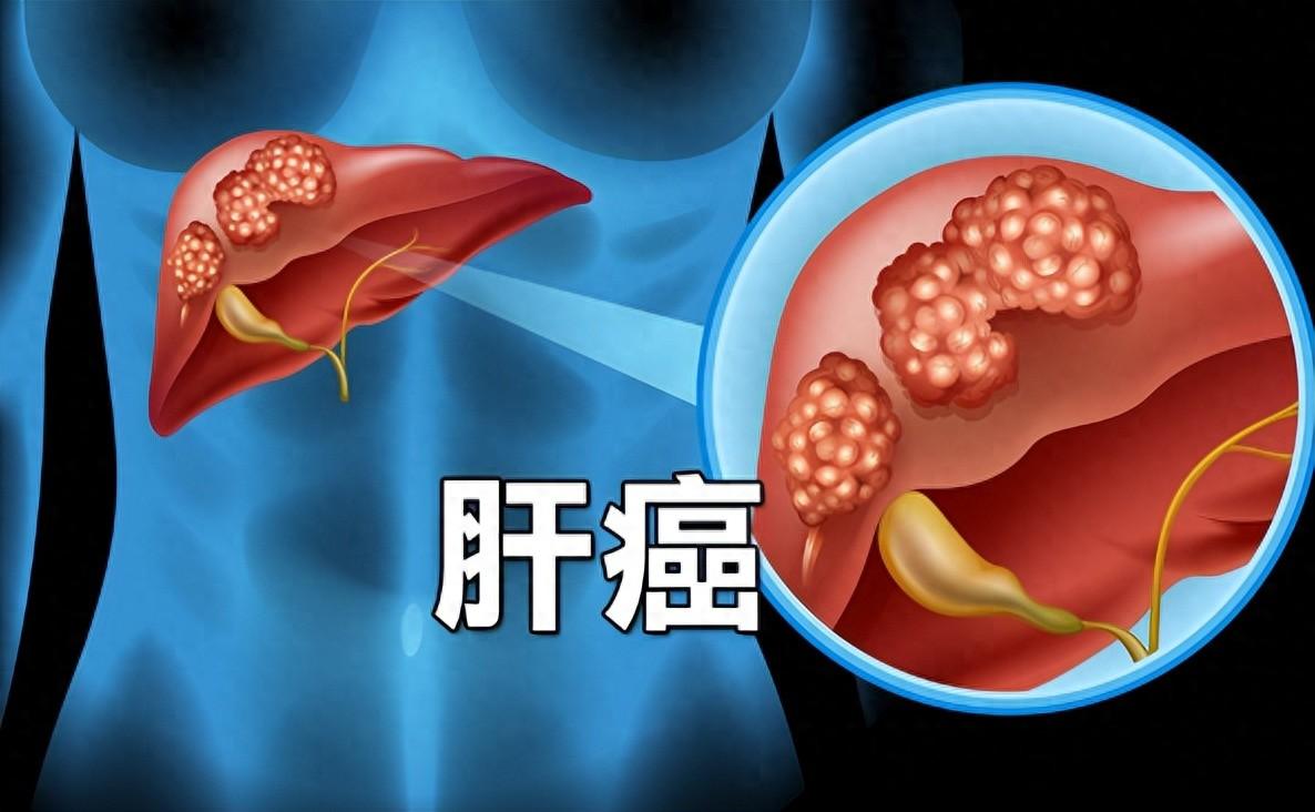 补多少硒合适