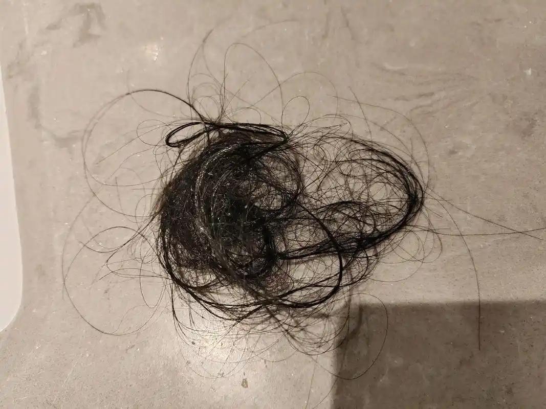 肺癌补硒吐血
