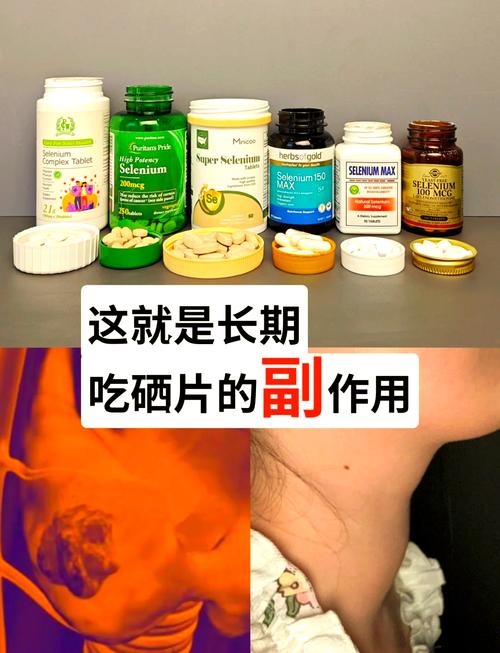 桥本补硒脱发